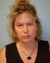 Before Image: Eyelid Surgery - front