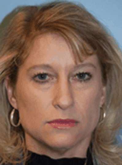 Before Image: Facelift - front