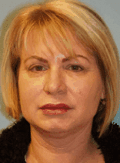 Before Image: Facelift - front