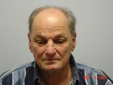 Before Image: Hair Restoration - front
