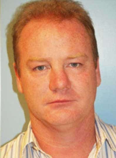 Before Image: Male Cosmetic Surgery - front