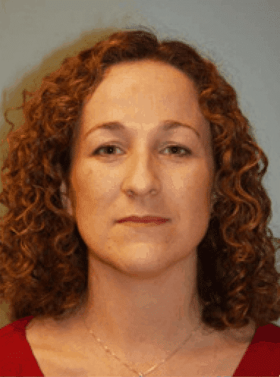 Before Image: Rhinoplasty - front