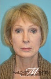 After Image: Voluma XC - front